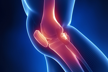 整形外科イメージ